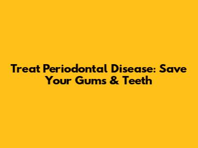 Treat Periodontal Disease: Save Your Gums & Teeth